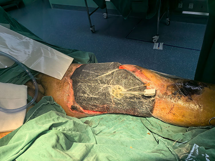 ����-����ע��(ƽ̨��վ)